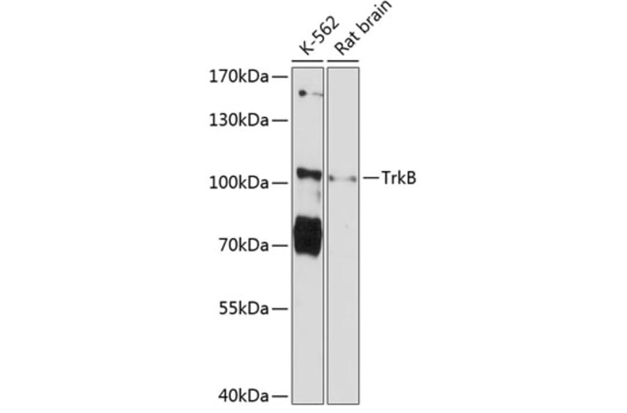 Western Blot - Anti-TrkB Antibody (A87878) - Antibodies.com