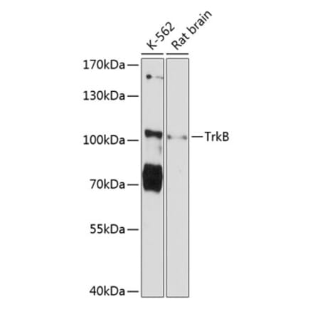 Western Blot - Anti-TrkB Antibody (A87878) - Antibodies.com