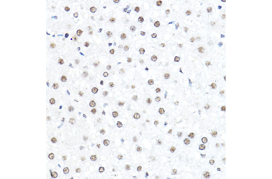 Immunohistochemistry - Anti-SP1 Antibody (A87879) - Antibodies.com