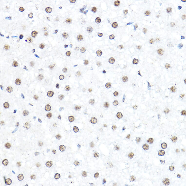 Immunohistochemistry - Anti-SP1 Antibody (A87879) - Antibodies.com