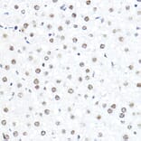Immunohistochemistry - Anti-SP1 Antibody (A87879) - Antibodies.com