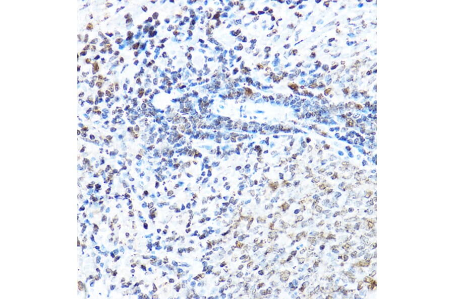 Immunohistochemistry - Anti-SP1 Antibody (A87879) - Antibodies.com