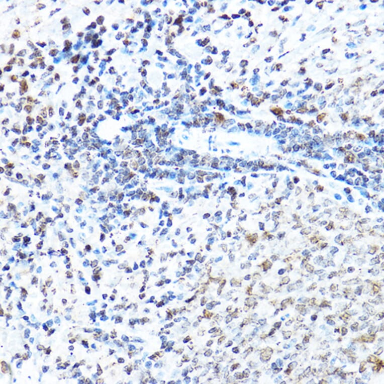 Immunohistochemistry - Anti-SP1 Antibody (A87879) - Antibodies.com
