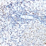 Immunohistochemistry - Anti-SP1 Antibody (A87879) - Antibodies.com