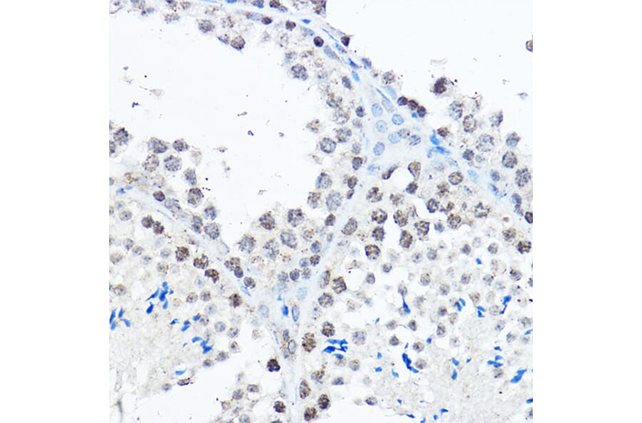 Immunohistochemistry - Anti-SP1 Antibody (A87879) - Antibodies.com