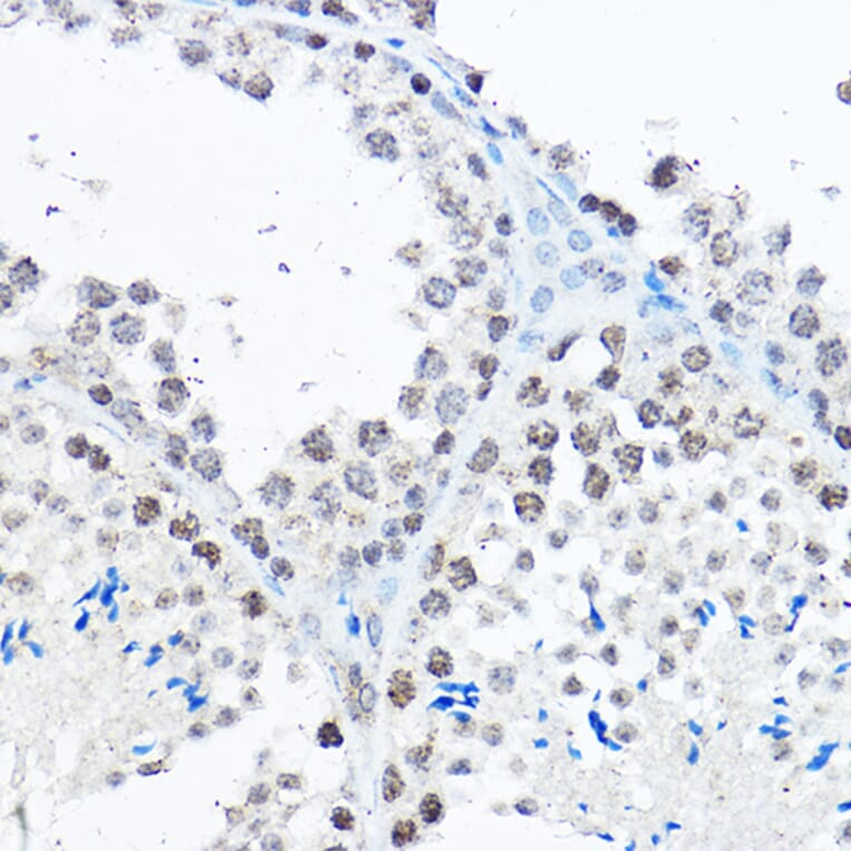 Immunohistochemistry - Anti-SP1 Antibody (A87879) - Antibodies.com
