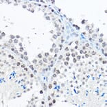 Immunohistochemistry - Anti-SP1 Antibody (A87879) - Antibodies.com