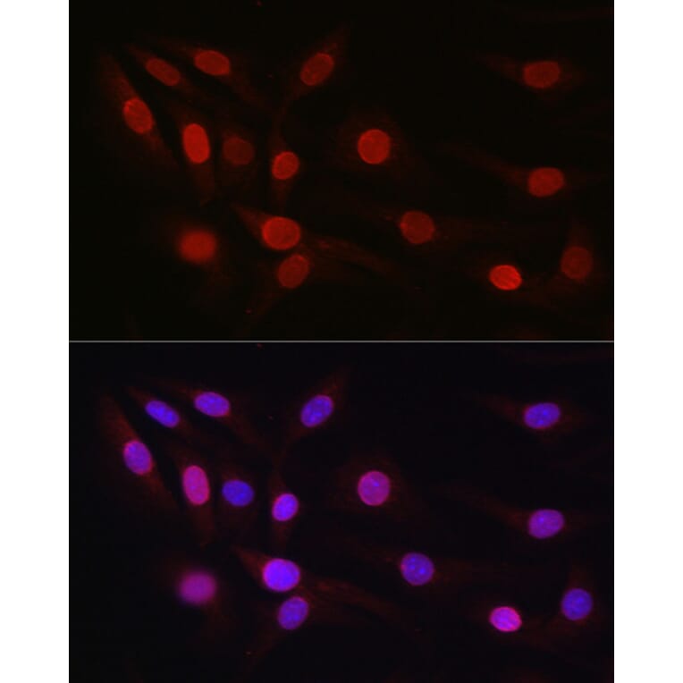 Immunofluorescence - Anti-SP1 Antibody (A87879) - Antibodies.com