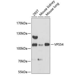 Western Blot - Anti-VPS54 Antibody (A87880) - Antibodies.com