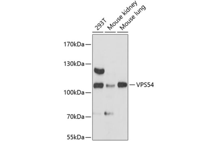 Western Blot - Anti-VPS54 Antibody (A87880) - Antibodies.com