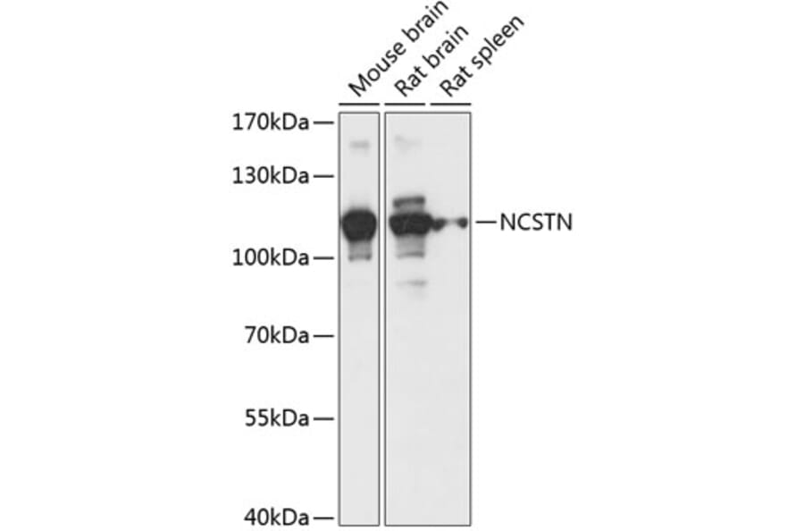 Western Blot - Anti-Nicastrin Antibody (A87881) - Antibodies.com