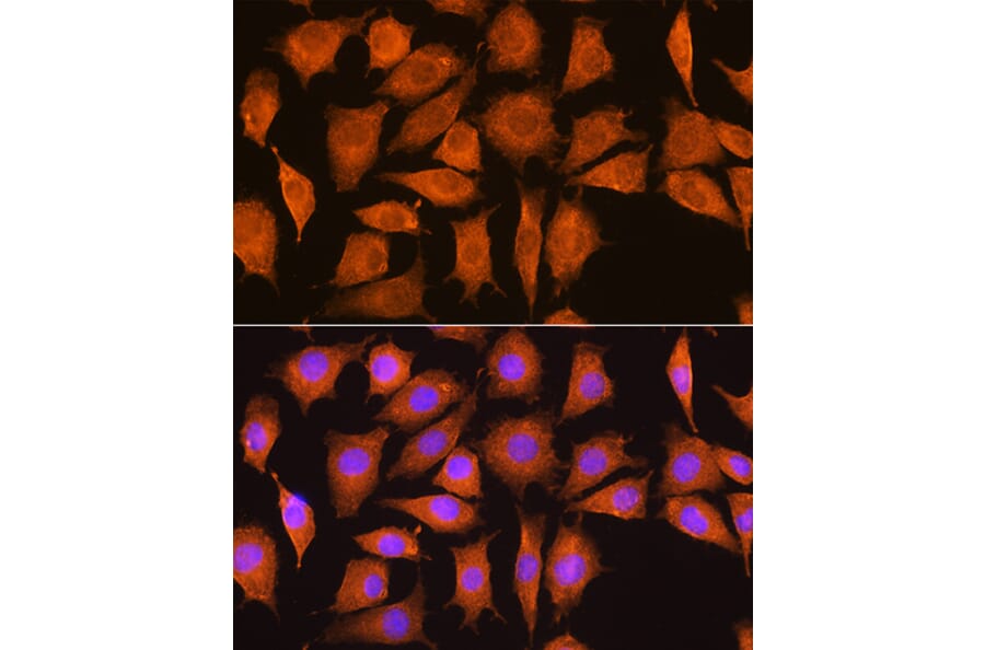 Immunofluorescence - Anti-Nicastrin Antibody (A87881) - Antibodies.com