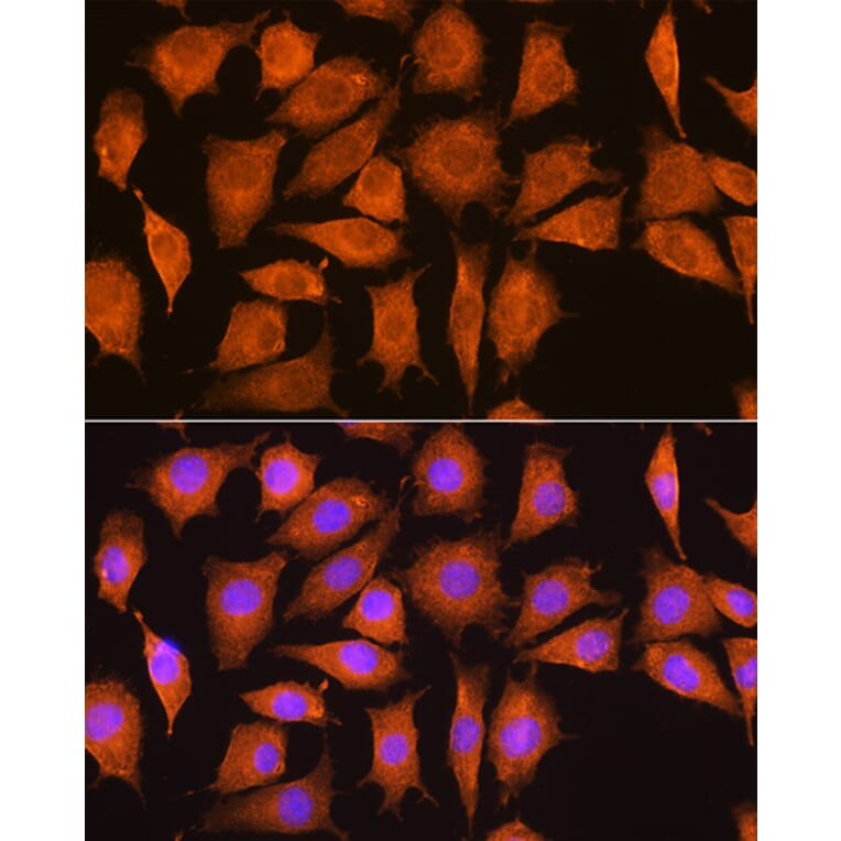 Immunofluorescence - Anti-Nicastrin Antibody (A87881) - Antibodies.com