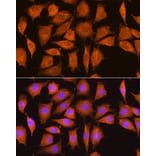 Immunofluorescence - Anti-Nicastrin Antibody (A87881) - Antibodies.com