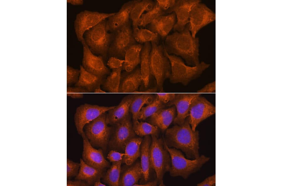 Immunofluorescence - Anti-Nicastrin Antibody (A87881) - Antibodies.com