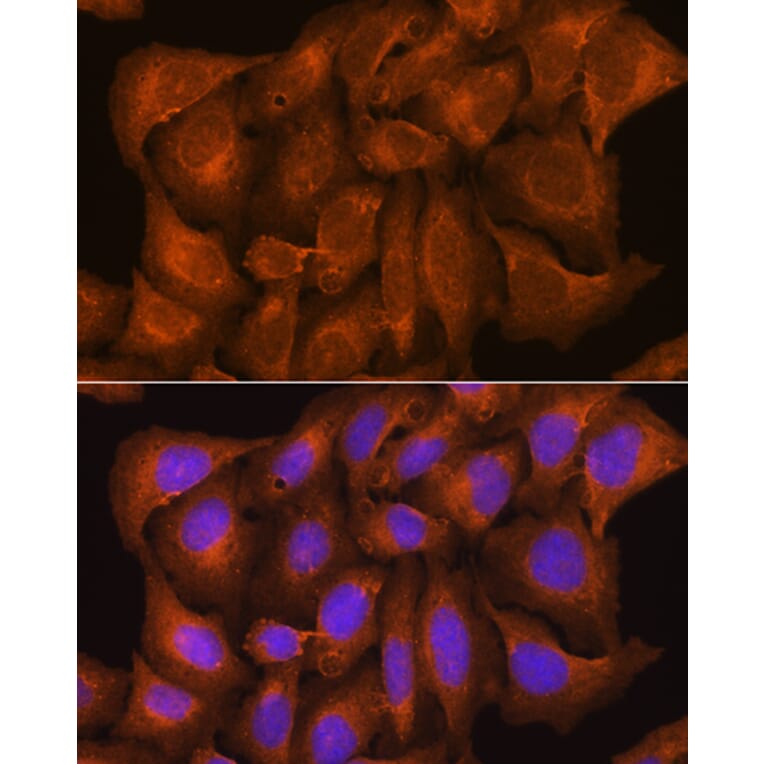 Immunofluorescence - Anti-Nicastrin Antibody (A87881) - Antibodies.com