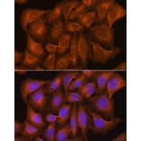 Immunofluorescence - Anti-Nicastrin Antibody (A87881) - Antibodies.com