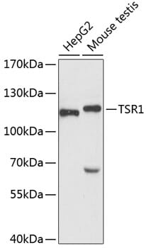 Western blot analysis of extracts of various cell lines, using Anti-TSR1 Antibody (A4842) at 1:3000 dilution.
Secondary antibody: Goat Anti-Rabbit IgG (H+L) (HRP) (AS014) at 1:10,000 dilution.
Lysates / proteins: 25µg per lane.
Blocking buffer: 3% non-fat dry milk in TBST.
Detection: ECL Basic Kit (RM00020).
Exposure time: 90s.