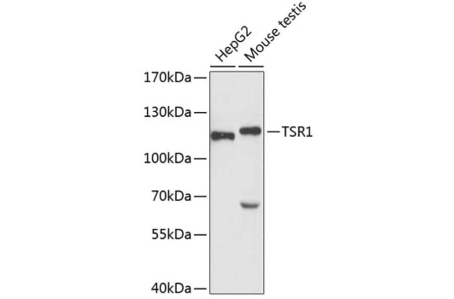 Western Blot - Anti-TSR1 Antibody (A87882) - Antibodies.com