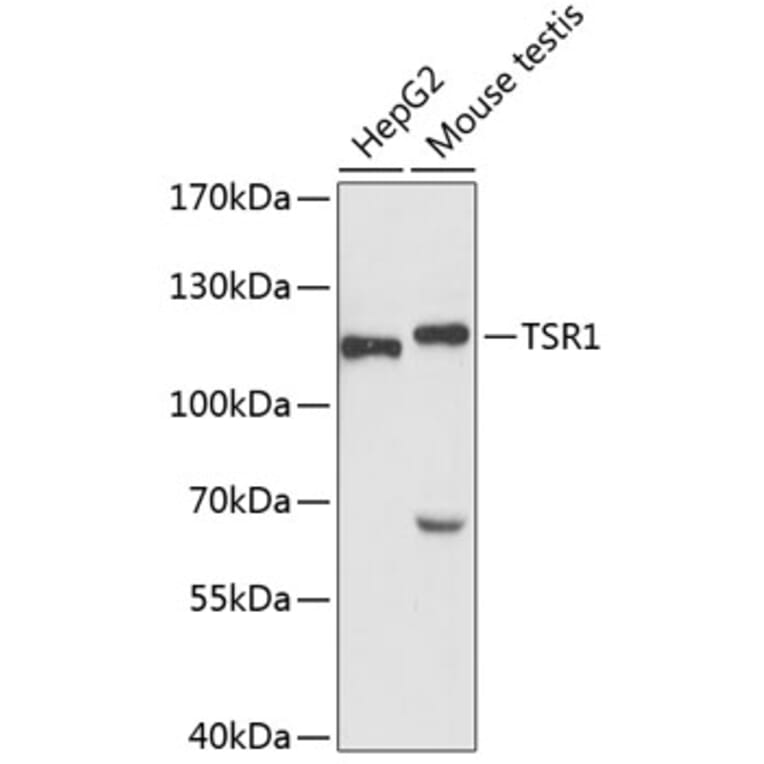 Western Blot - Anti-TSR1 Antibody (A87882) - Antibodies.com