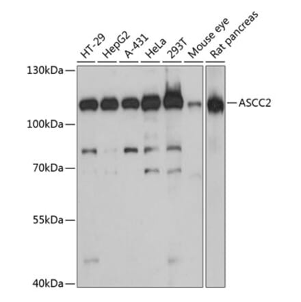 Western Blot - Anti-ASCC2 Antibody (A87883) - Antibodies.com