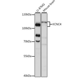Western Blot - Anti-KCNC4 Antibody (A87884) - Antibodies.com
