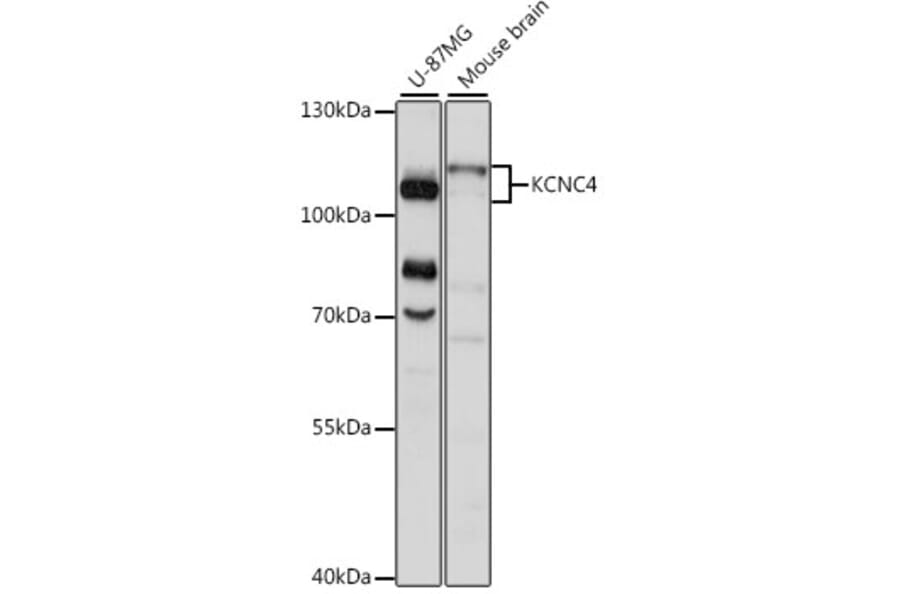 Western Blot - Anti-KCNC4 Antibody (A87884) - Antibodies.com