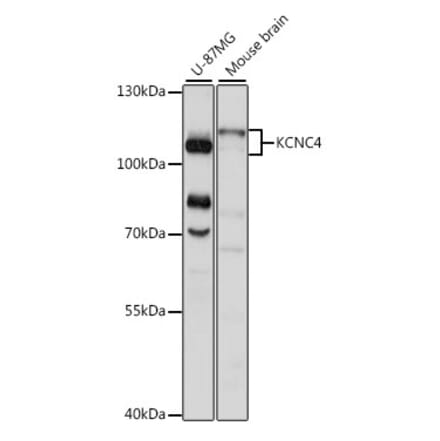 Western Blot - Anti-KCNC4 Antibody (A87884) - Antibodies.com