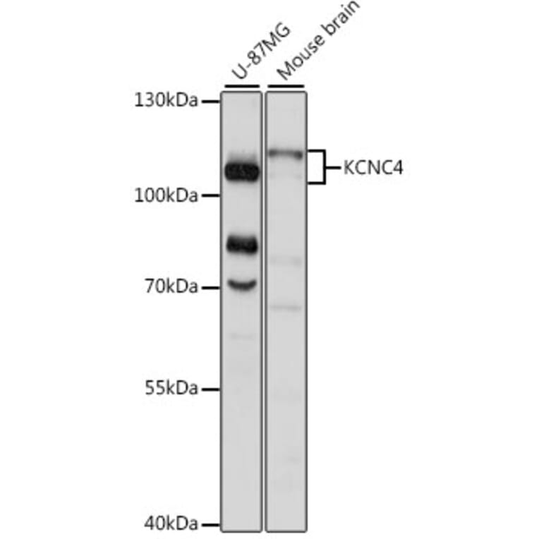 Western Blot - Anti-KCNC4 Antibody (A87884) - Antibodies.com