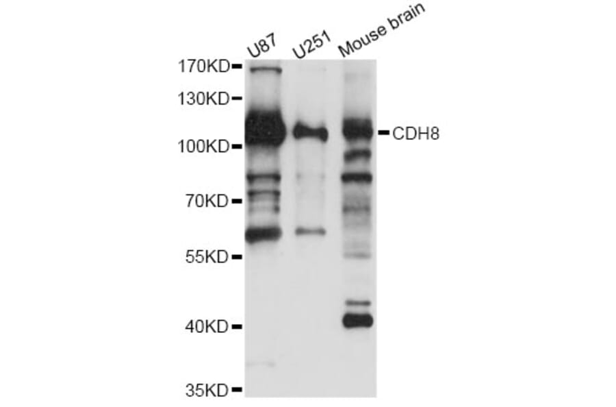 Western Blot - Anti-CDH8 Antibody (A14236) - Antibodies.com