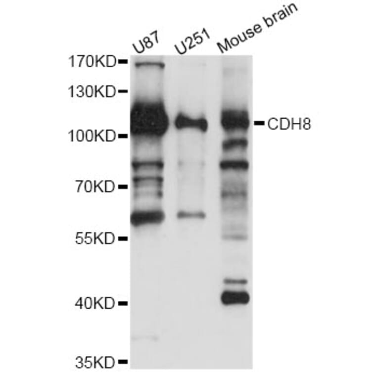 Western Blot - Anti-CDH8 Antibody (A14236) - Antibodies.com