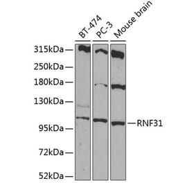 Western Blot - Anti-RNF31/HOIP Antibody (A87886) - Antibodies.com