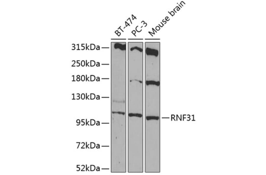 Western Blot - Anti-RNF31/HOIP Antibody (A87886) - Antibodies.com