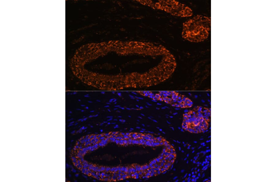 Immunofluorescence - Anti-RNF31/HOIP Antibody (A87886) - Antibodies.com