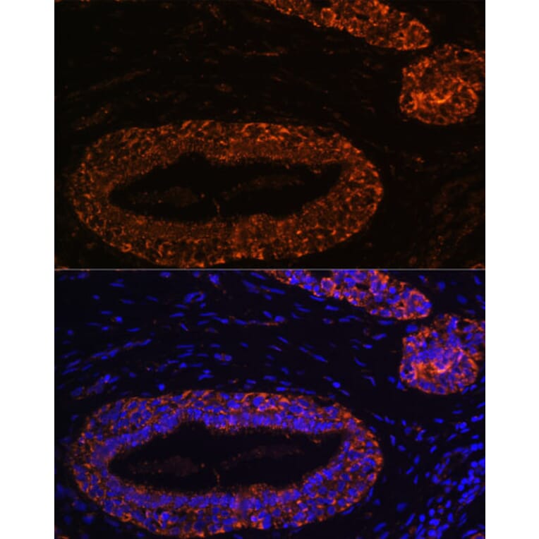 Immunofluorescence - Anti-RNF31/HOIP Antibody (A87886) - Antibodies.com