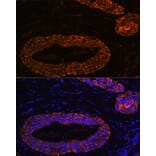Immunofluorescence - Anti-RNF31/HOIP Antibody (A87886) - Antibodies.com