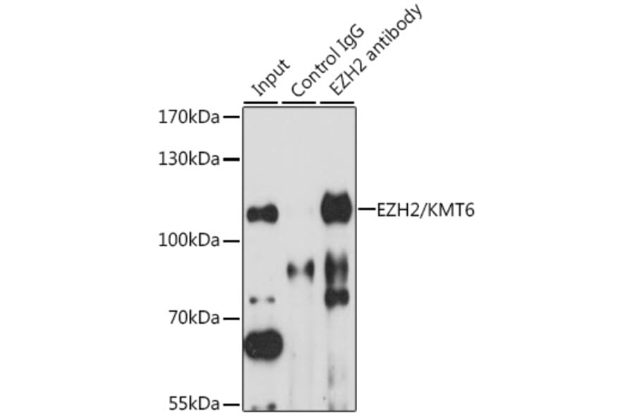 Western Blot - Anti-EZH2 Antibody (A87887) - Antibodies.com