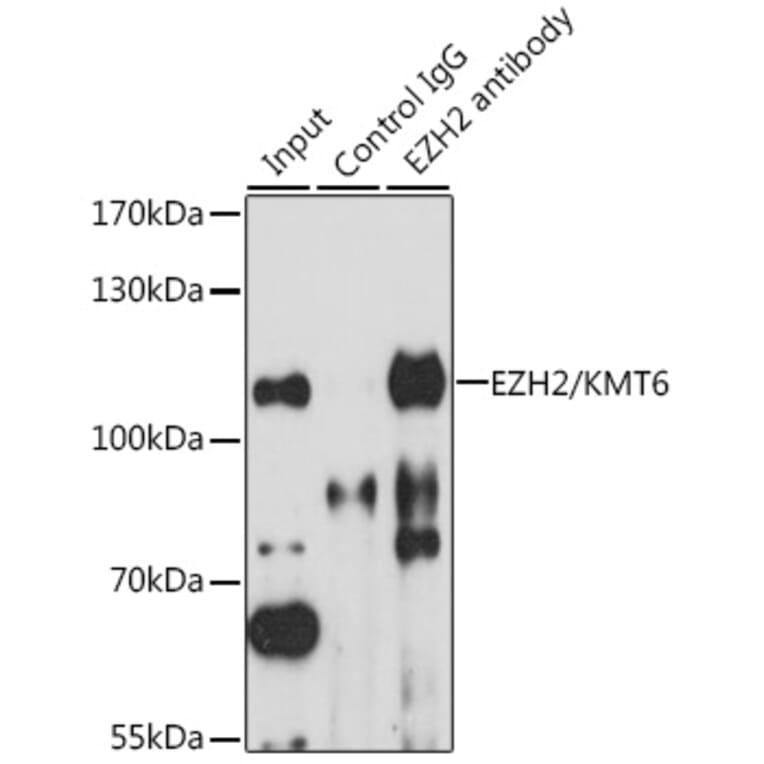 Western Blot - Anti-EZH2 Antibody (A87887) - Antibodies.com