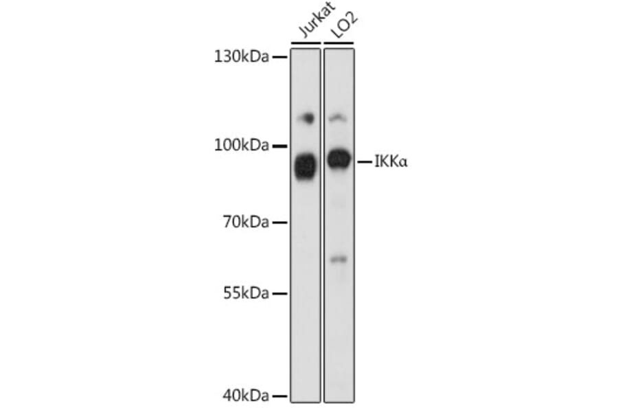 Western Blot - Anti-IKK alpha Antibody (A87888) - Antibodies.com