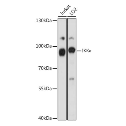 Western Blot - Anti-IKK alpha Antibody (A87888) - Antibodies.com