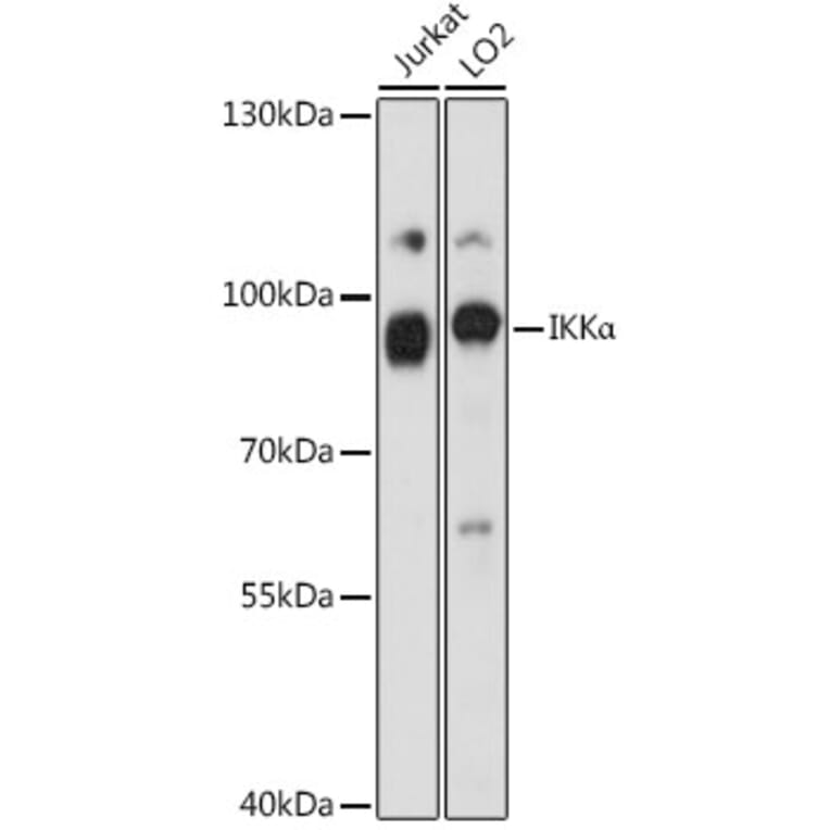 Western Blot - Anti-IKK alpha Antibody (A87888) - Antibodies.com