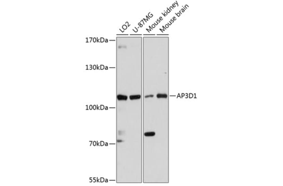 Western Blot - Anti-AP3 Antibody (A87889) - Antibodies.com