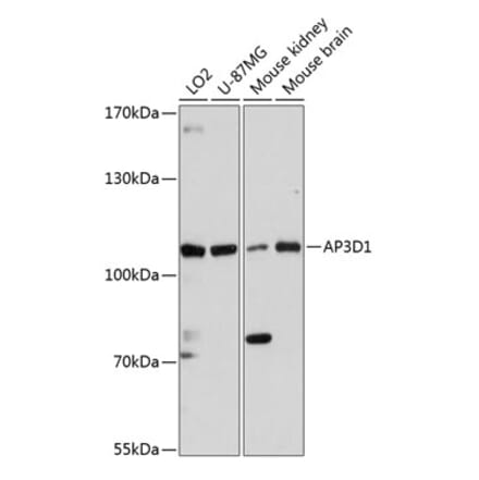 Western Blot - Anti-AP3 Antibody (A87889) - Antibodies.com