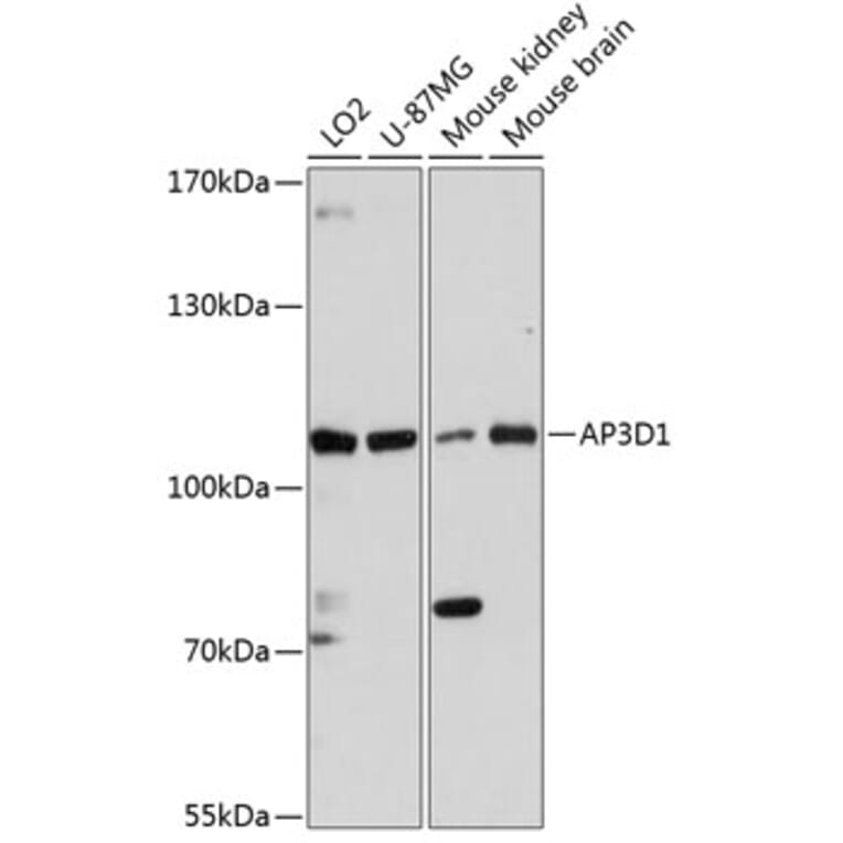 Western Blot - Anti-AP3 Antibody (A87889) - Antibodies.com