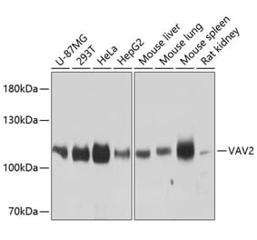 Western Blot - Anti-VAV2 Antibody (A87890) - Antibodies.com