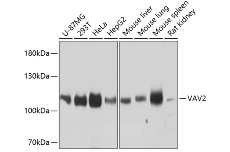 Western Blot - Anti-VAV2 Antibody (A87890) - Antibodies.com