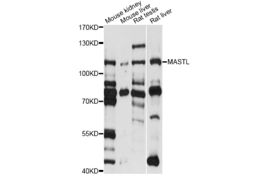 Western Blot - Anti-MASTL Antibody (A14294) - Antibodies.com