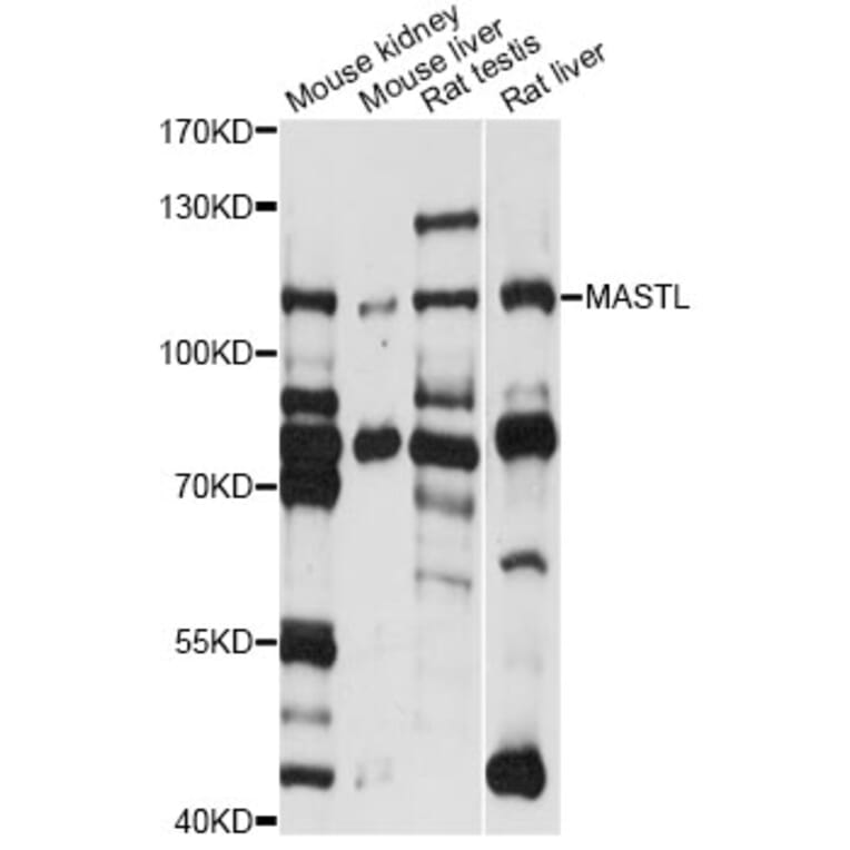 Western Blot - Anti-MASTL Antibody (A14294) - Antibodies.com