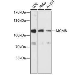 Western Blot - Anti-MCM8 Antibody (A87892) - Antibodies.com