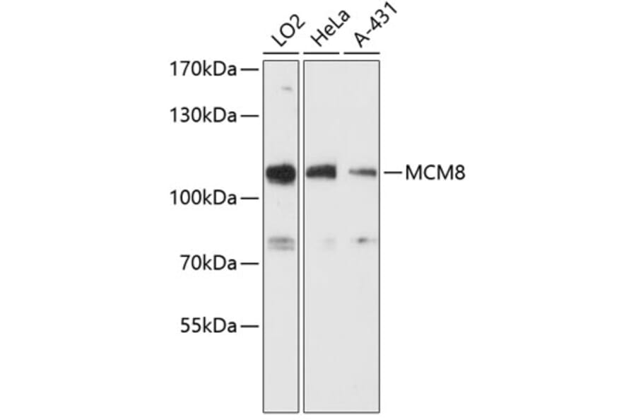 Western Blot - Anti-MCM8 Antibody (A87892) - Antibodies.com